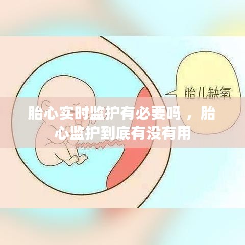 胎心实时监护有必要吗 ，胎心监护到底有没有用