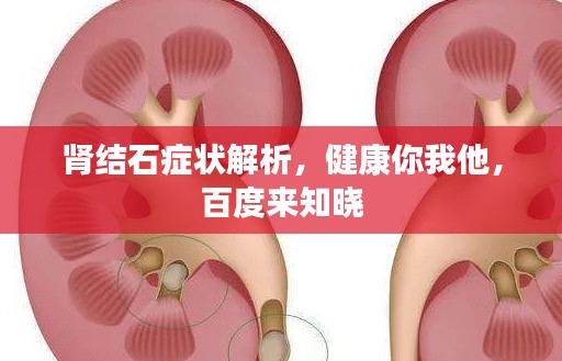 肾结石症状解析，健康你我他，百度来知晓